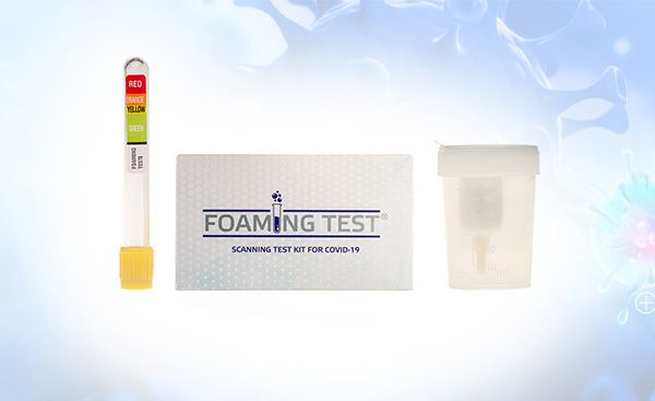 Foaming Test - Covid-19 Test Kiti